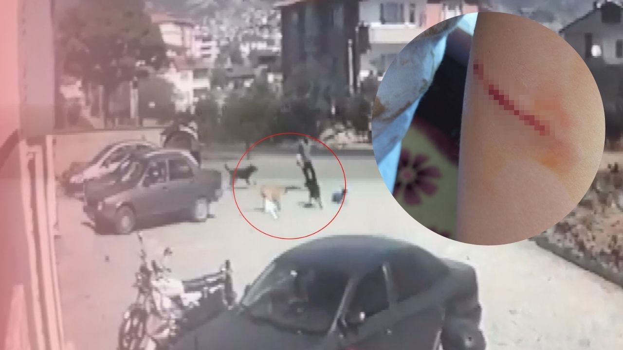 Sokak köpeklerinin saldırdığı çocuğu babası kurtardı