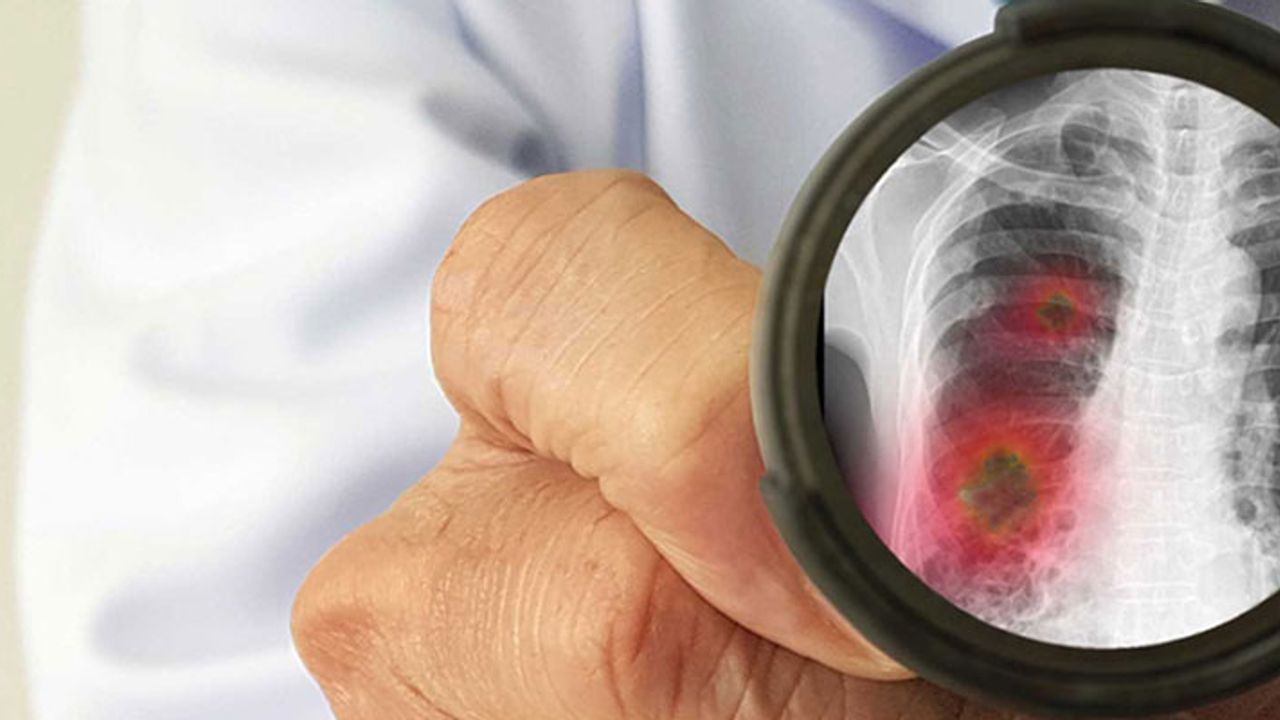 Uzman doktordan uyarı: Sigara içenler bu hastalıkları daha ağır geçiriyor!
