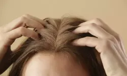 Saçlarınız çabuk yağlanıyorsa bu yöntemleri deneyin!