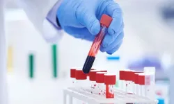 Devrim yaratacak kan testi: Kanseri 7 yıl önceden tespit etmek mümkün!