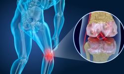 Uzman doktor açıkladı: Eklem hastalıklarında bu tedavi ile iyileşmek mümkün!