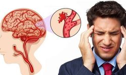 Beyin Sağlığını Korumak Alzheimer Riskini Azaltıyor