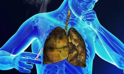 Uzman doktor uyardı: Sigara bu hastalığın riskini artırıyor!