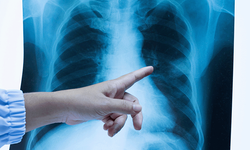 Uzman hekimden vatandaşlara uyarı: Bu hastalık sessiz ilerliyor!