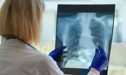 Uzmanlar uyardı: Kadınlarda da bu kanser türü artıyor!