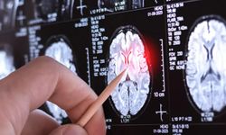 Yeni Keşfedildi: Dünyada Yalnızca 13 Kişide Görülüyor! Bilim Dünyası Şaşkın