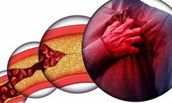 Kardiyoloji uzmanından uyarı: Kalp sağlığını korumak için bunları yapın!