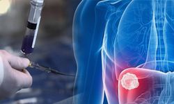 Uzman doktor açıkladı: Kanser tedavisinde bu yaklaşımlar öne çıkıyor