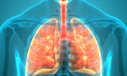 Uzmanından uyarı! Bu hastalık yüksek ölüm oranına sahip: Risk oluşturmaya devam ediyor!