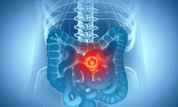 Çocukken yapılan bu alışkanlıklar genç yaşta kanser riskini artırıyor