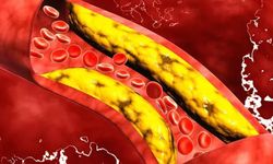 Kardiyoloji uzmanı uyardı! Risk yağın türünde: Bunlar kolesterolü düşürüyor!