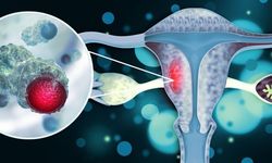 Uzman doktordan uyarı: Aşı ve düzenli kontrol bu kanser türüne karşı kalkan oluyor!