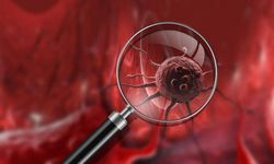 Uzman doktor açıkladı! Kanserle mücadelede 3 aşama var: Erkeklerde daha yüksek!