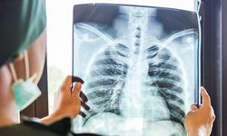 Uzman doktor uyardı! Griptir geçer demeyin: Zatürre tehlikesi var!