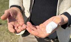 Başıboş pitbull saldırdı! Vatandaş ve köpeği yaralandı: Yaşananları anlattı!