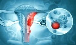 Hekimler farkındalık için buluştu: Endometriozis hastalığına dikkat çekildi!