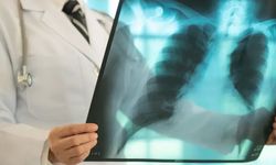 Ölümcül tehdit sürüyor: 1 milyondan fazla can aldı