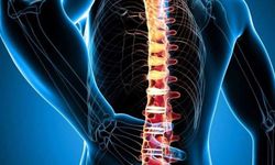 Uzmanlar uyardı! Fıtık deyip geçmeyin: Ameliyatı önleyebilir!