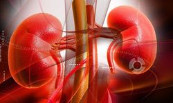 Böbrek Taşı Belirtileri Nelerdir? Uzmandan Kritik Uyarı