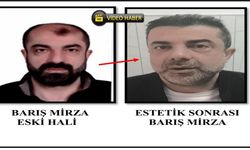 Ameliyatla yüzünü değiştirdi: 7 yıllık firar son buldu