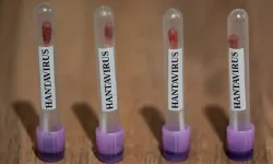 Sağlık Bakanlığı açıkladı: Türkiye’de hantavirüs vakası var mı?