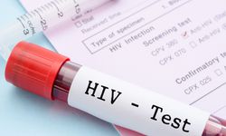 Cinsel yolla bulaşan HIV ve AIDS enfeksiyonu dünyada azalıyor Türkiye'de artıyor..!