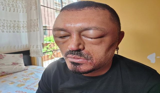 Eczaneden değil internetten alırsanız yüzünüz böyle olur!
