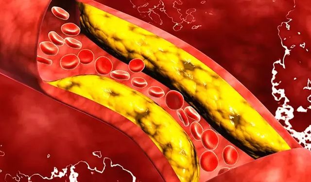 Kardiyoloji uzmanı uyardı! Risk yağın türünde: Bunlar kolesterolü düşürüyor!