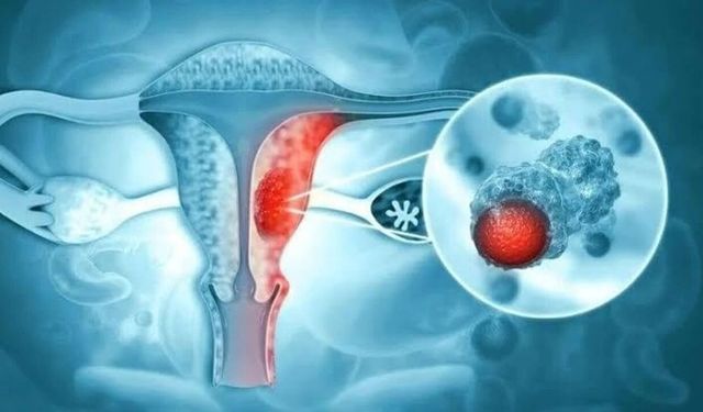 Hekimler farkındalık için buluştu: Endometriozis hastalığına dikkat çekildi!