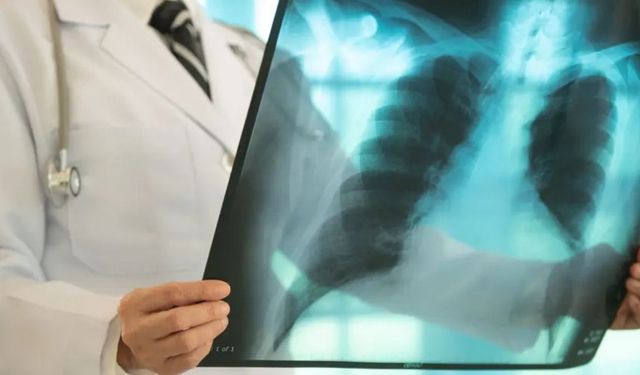 Ölümcül tehdit sürüyor: 1 milyondan fazla can aldı