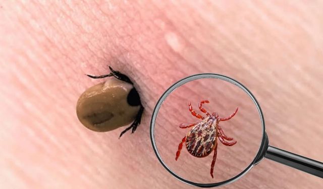 Kene ısırıklarına karşı kritik uyarı: Yanlış müdahale ölüm riskini artırıyor!