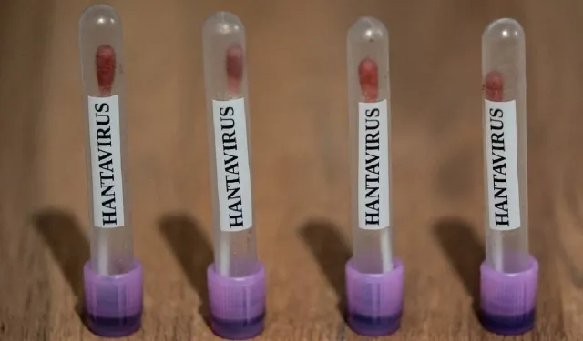 Sağlık Bakanlığı açıkladı: Türkiye’de hantavirüs vakası var mı?