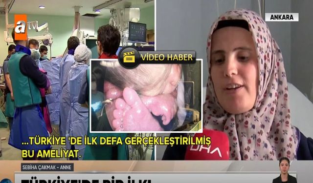 Dünya Kastamonulu anneyi konuşuyor: Anne karnında mucize ameliyat