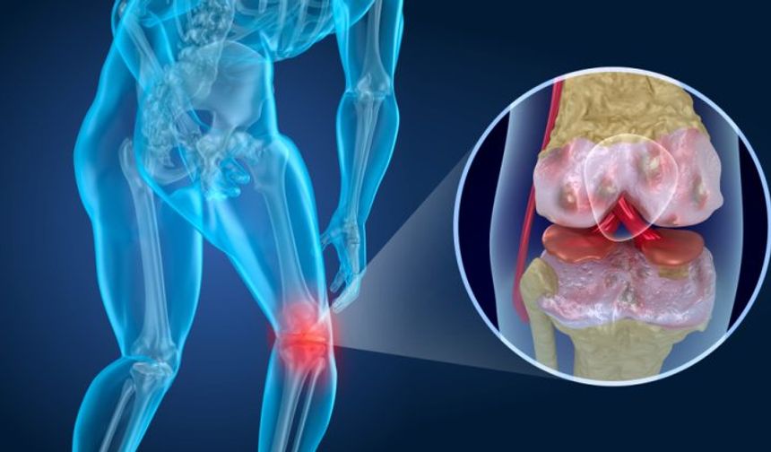 Uzman doktor açıkladı: Eklem hastalıklarında bu tedavi ile iyileşmek mümkün!