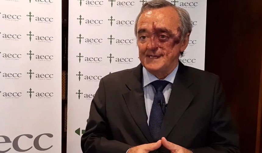 Pankreas kanserinde ezber bozan yöntem: İspanyol bilim insanı açıkladı