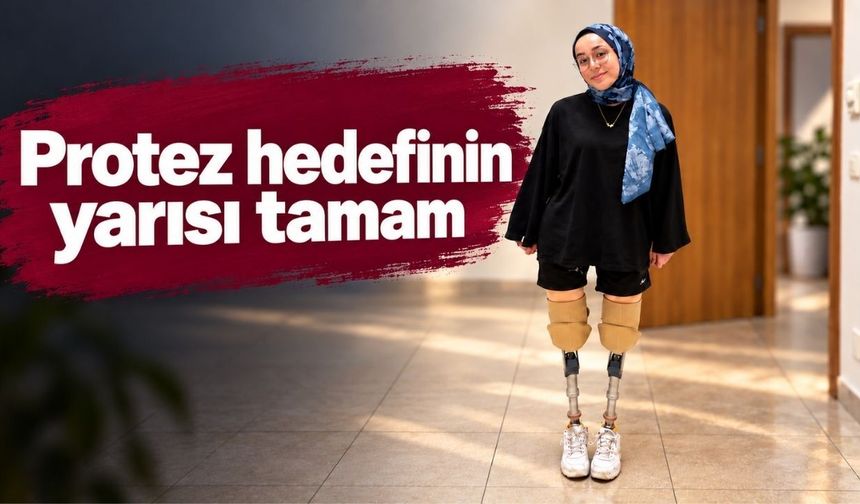 Kastamonulu Halime’ye destek büyüyor: Protez hedefinin yarısı tamam