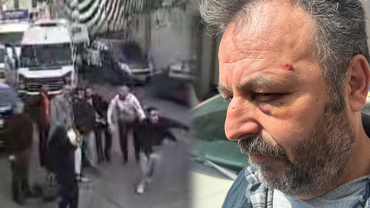 Istanbul Trafiginde Baba Ve Ogluna Levyeli Saldiri Bir Anda 20 Kisi Geldiler Bir Sey Yapamadim Cc1W