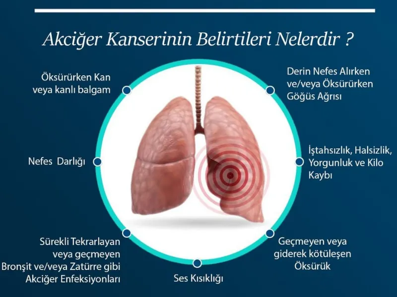 Kastamonu İl Sağlık Müdürü'nden Önemli Akciğer Kanseri Açıklaması!