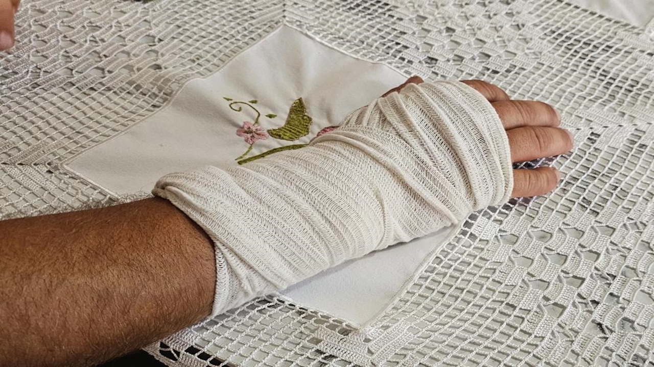 Cide Sokak Köpeği Saldırısı (3)