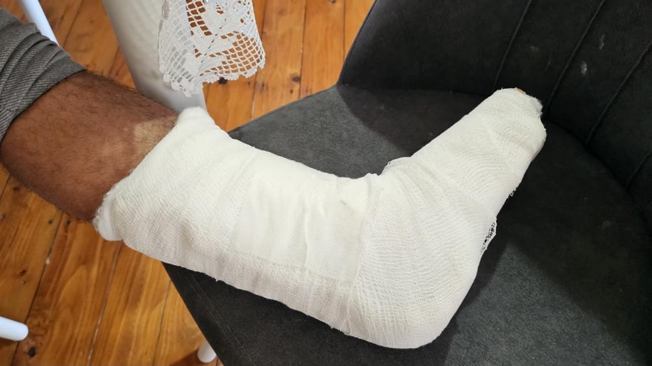 Cide Sokak Köpeği Saldırısı (4)