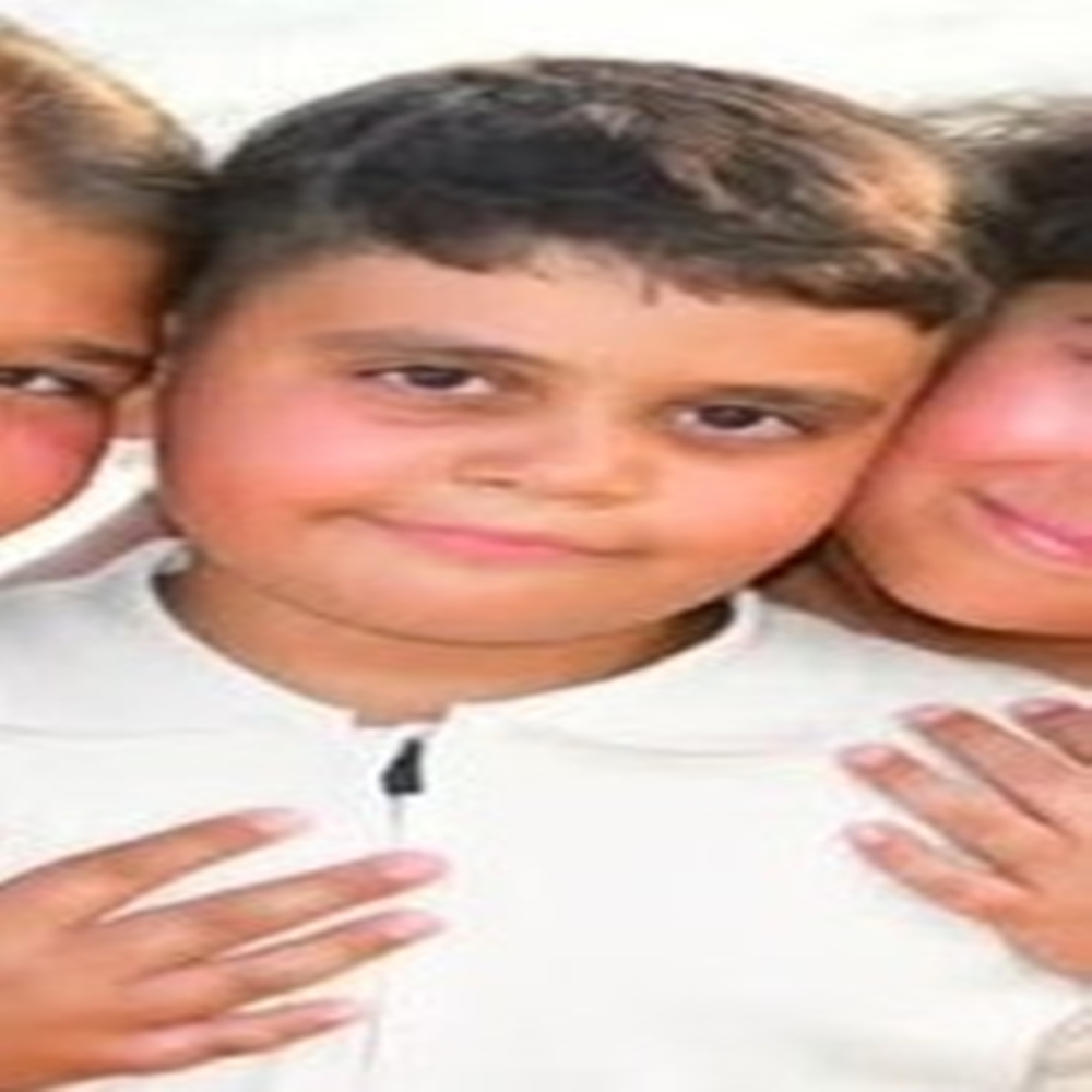 Aile Faciası (2)