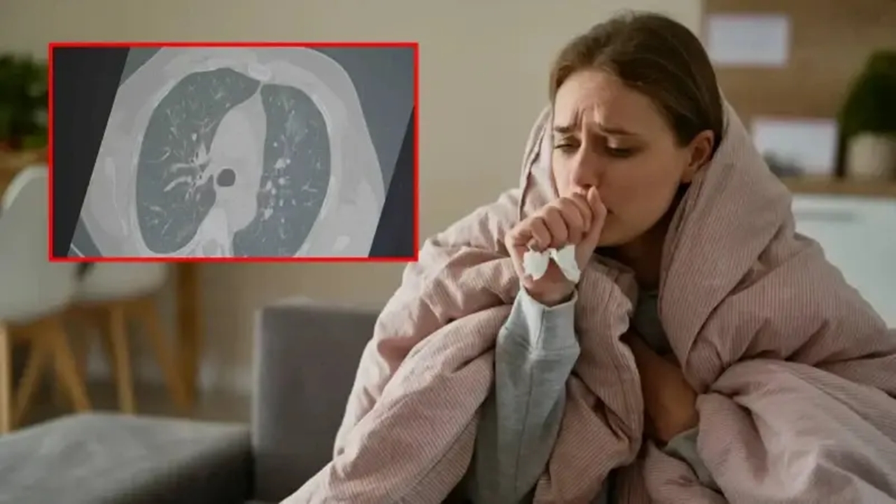 Grip Ve Kovid Frankenstein (2)