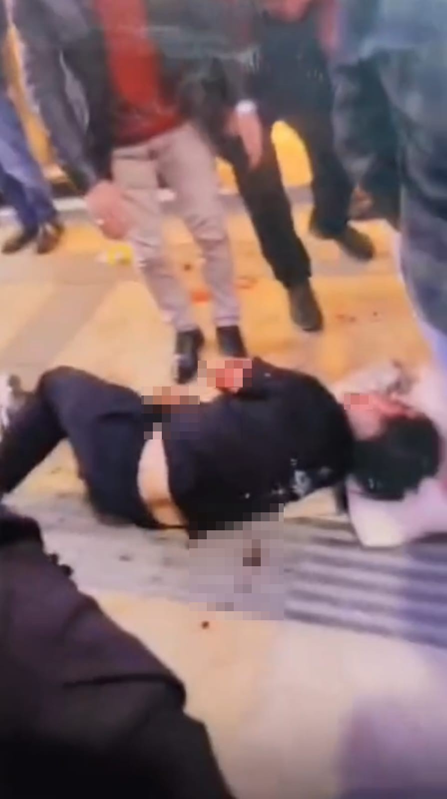 Boşanma Aşamasındaki Eşi Tarafından Bıçaklanan Kadın Yaralandı 2