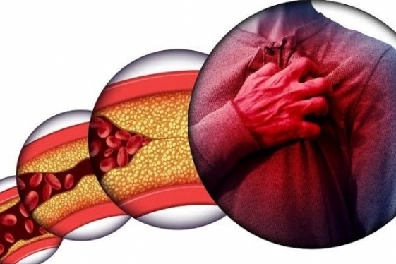 Kardiyoloji Uzmanından Uyarı Kalp Sağlığını Korumak Için Bunları Yapın! 88