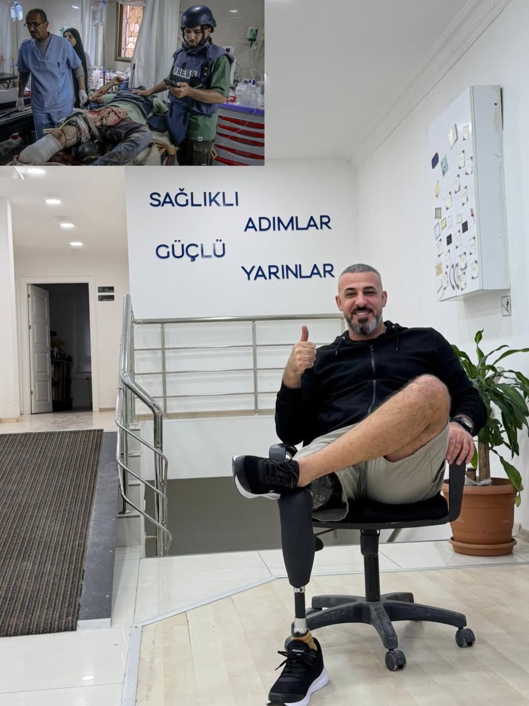 Kastamonu'da Konuk Edilmişti Bacağını Kaybeden Filistinli Gazetecinin Tedavi Süreci Başladı 400