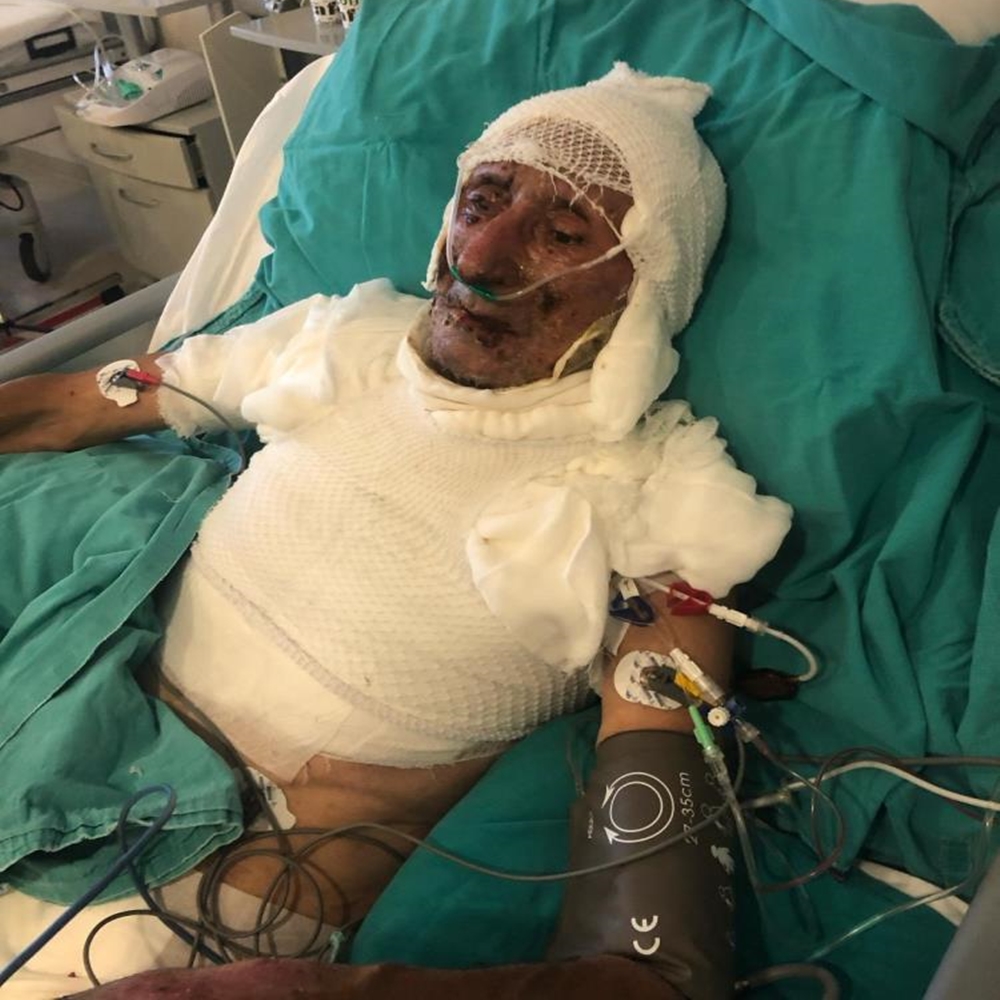 Ateyle Oynadığı Hakim Karxısı (4)