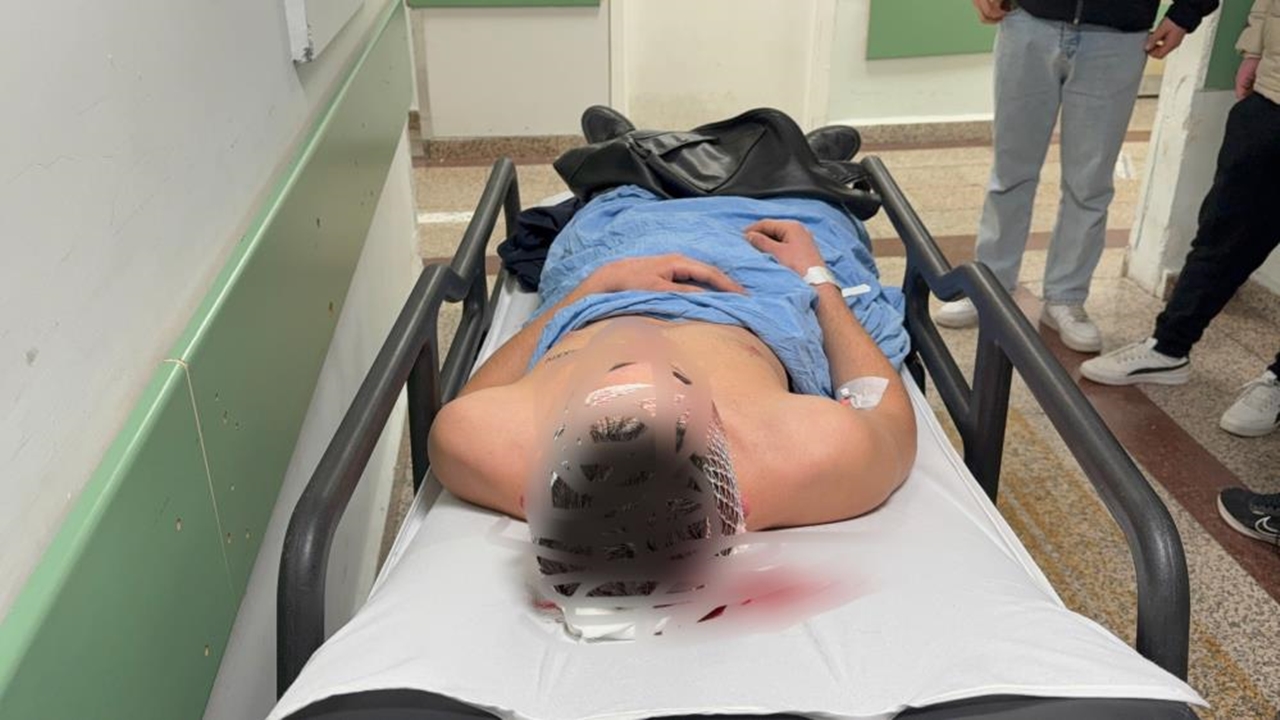 Samsurn Bıçaklı Saldırı (1)