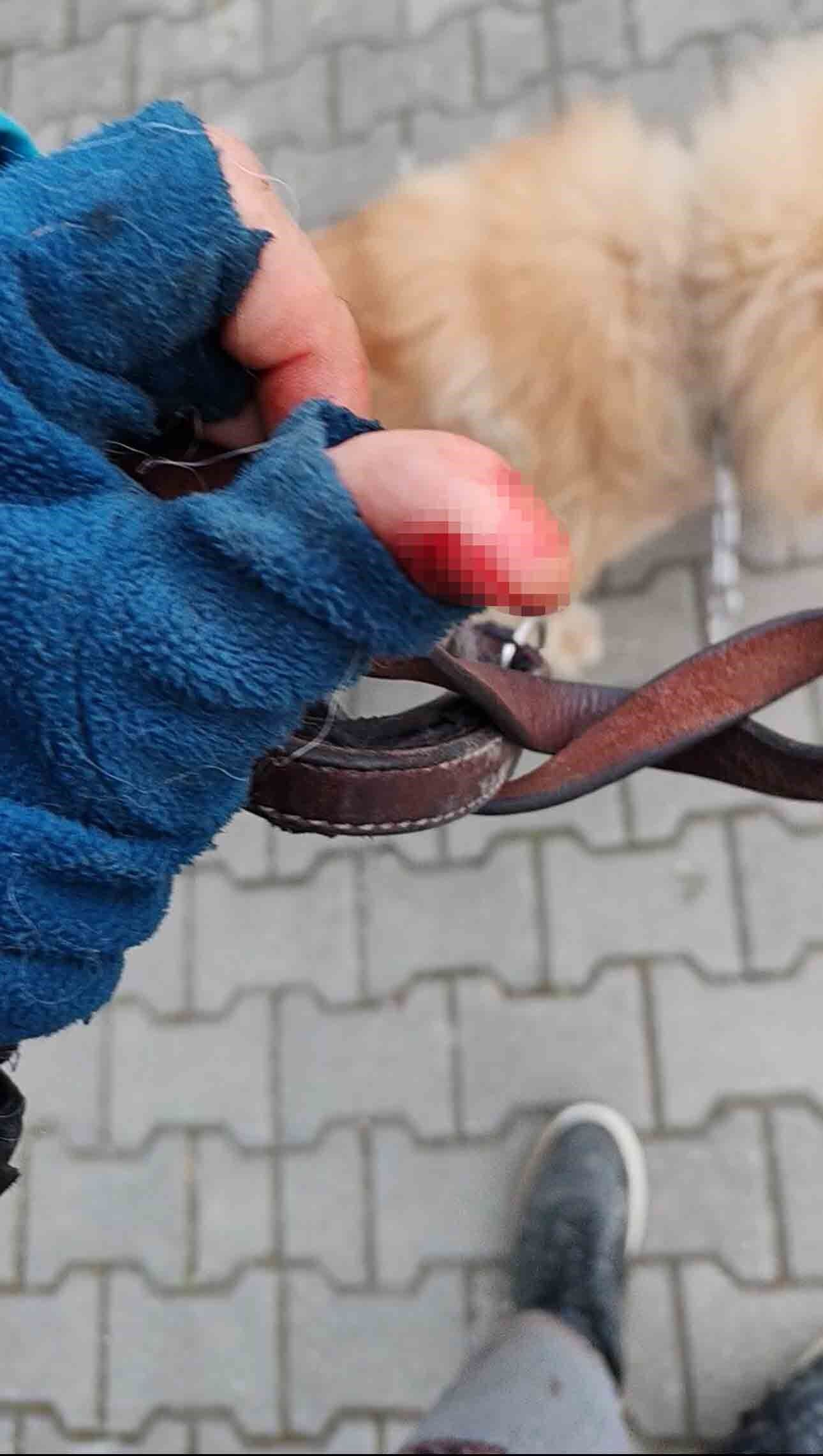 Başıboş Pitbull Saldırdı! Vatandaş Ve Köpeği Yaralandı Yaşananları Anlattı! 8