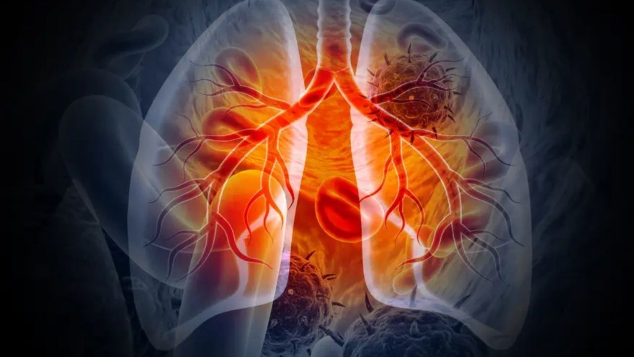 Ölümcül Tehdit Sürüyor 1 Milyondan Fazla Can Aldı (2)