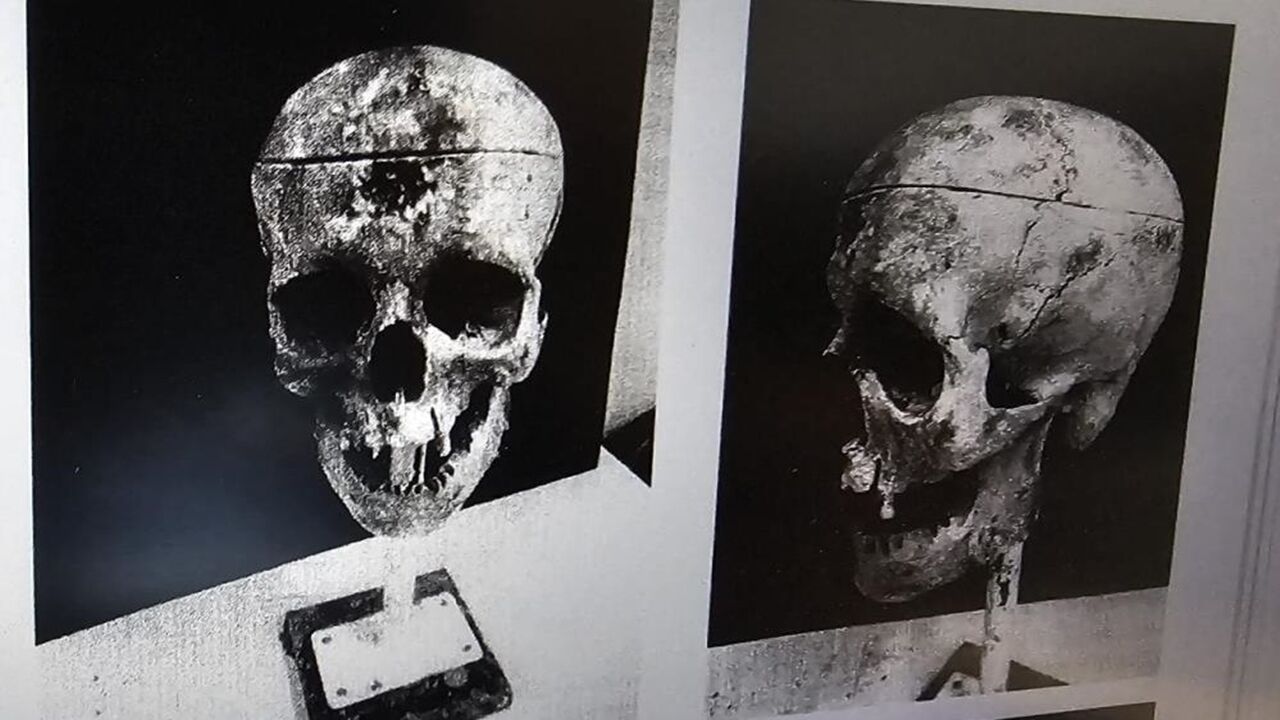 Zonguldak 18 Yıllık Cnayet Sırrı Çözüldü (4)